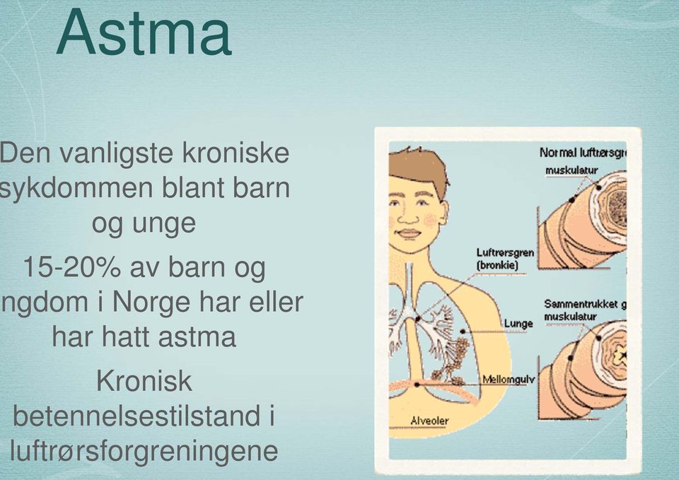 ngdom i Norge har eller har hatt astma