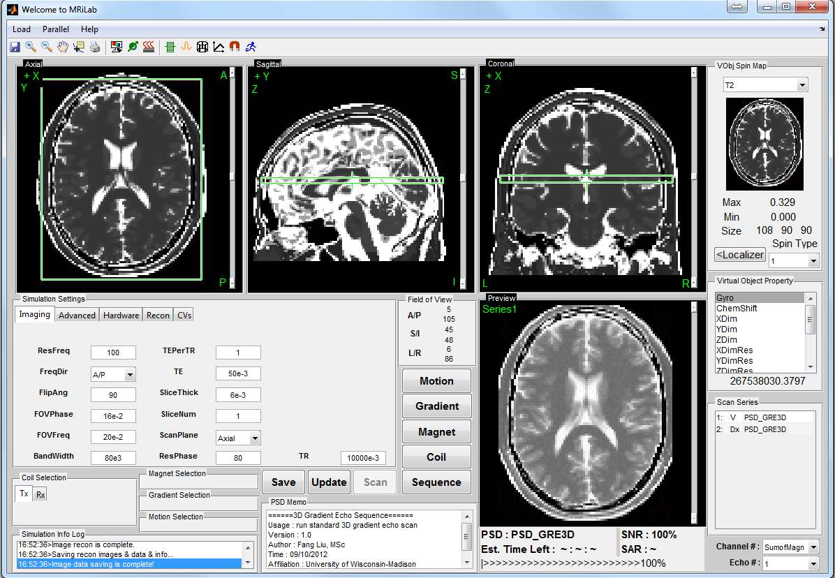 FYS-KJM 4740 MR-teori og medisinsk diagnostikk Magnettomografi-del Introduksjon Atle Bjørnerud, Rikshosptialet atle.bjornerud@fys.uio.