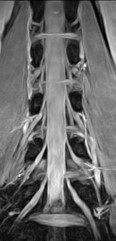 Hode Thorax Fasekontrast og kontrast-forsterket angiografi Mars 2006 FYS-KJM 4740 73 Fremstilling av blodårer i Thorax Mars 2006 FYS-KJM 4740 74 Abdomen Nakke/hals T2 vektet cervical columna