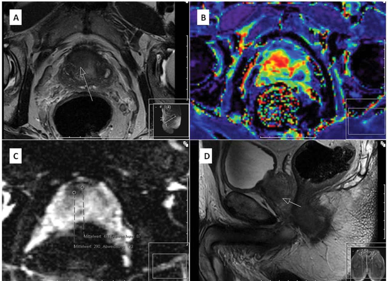 Cardiac MRI Thorasic MRI Mars 2006 FYS-KJM 4740 13 Mars 2006 FYS-KJM 4740 14 Orthopedic MRI MR mammopgrahy Mars 2006 FYS-KJM 4740 15 Mars 2006 FYS-KJM 4740 16 Noen få medisinske uttrykk