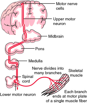 Amyotrofisk lateral sklerose (ALS) Nevrodegenerativ sykdom som kjennetegnes av