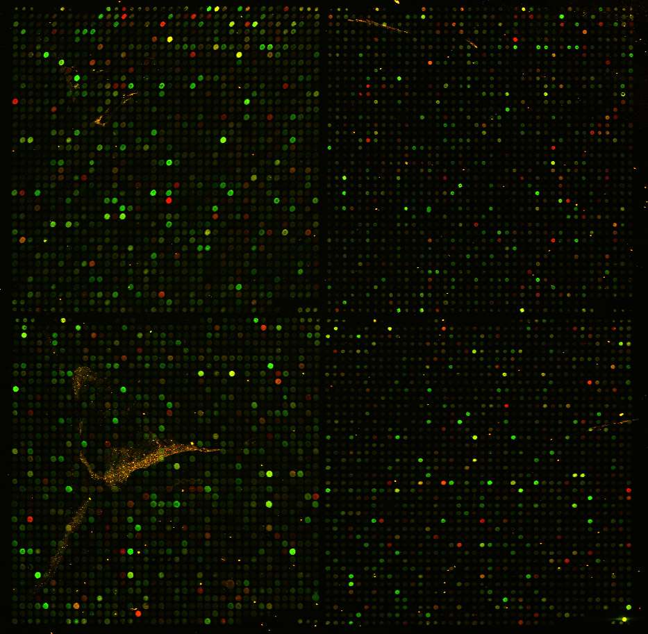Microarray - DNA chips Måle aktivitet til hvert gen uttrykket i en celle på et bestemt