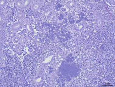 Atypisk furunkulose Utbrudd med atypisk furunkulose (A.salmonicida) Hovedsakelig type VI Noen individ dobbelt-infisert med type V og VI (PCR) Figur 3.