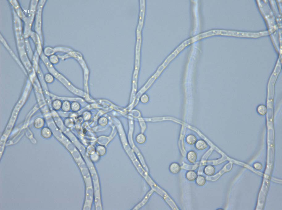 Fusarium langsethiae Photo: J.