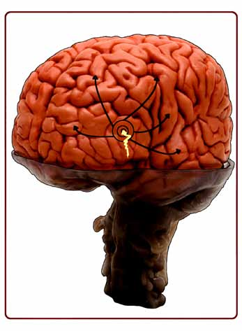 I Norge er det 40.000 50.000 mennesker som har epilepsi. Av disse er ca 20 % utviklingshemmede. En regner med at 2300 får diagnosen hvert år i Norge. Ca. halvparten får diagnosen før de fyller 16 år.