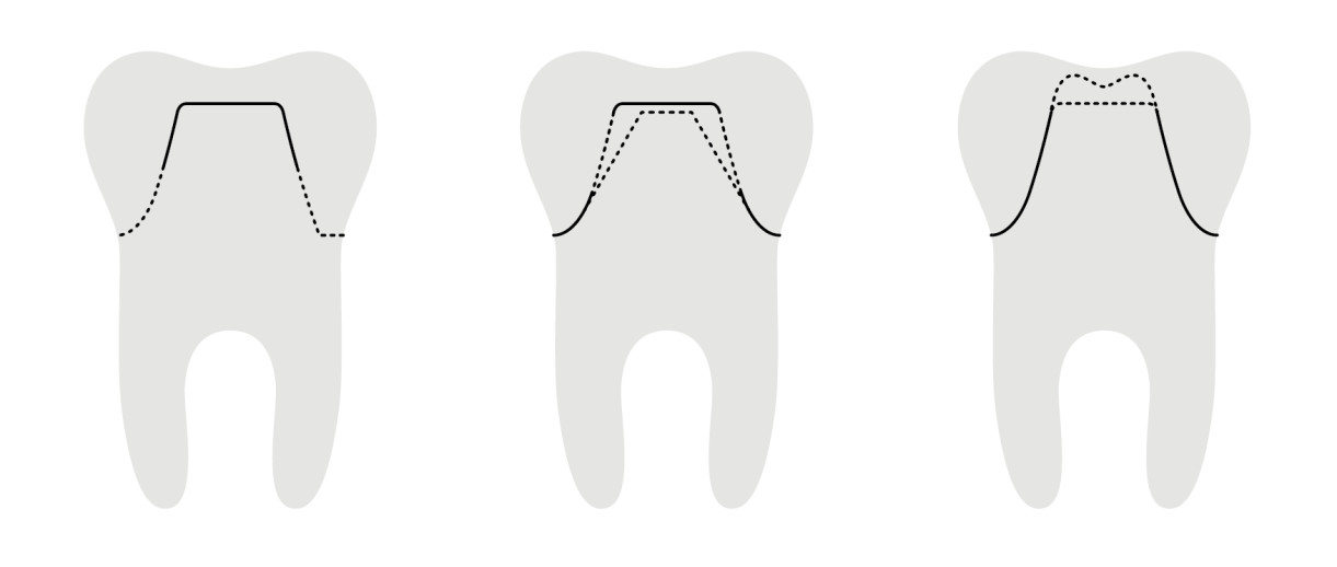 7 Det eksisterer ulike CAD/CAM-muligheter på markedet, og tannleger og tannteknikere kan velge å samarbeide på andre måter enn tidligere.