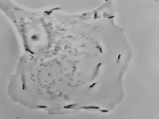 Bakterien Listeria monocytogenes beveger seg inne i - og mellom makrofager ved hjelp av aktin Eksempler