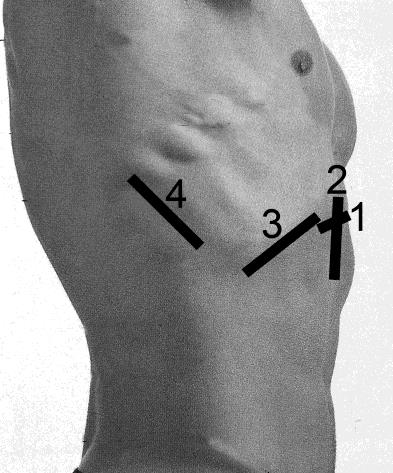 6+ Stasjon 1 Transversalsnitt i epigastriet.