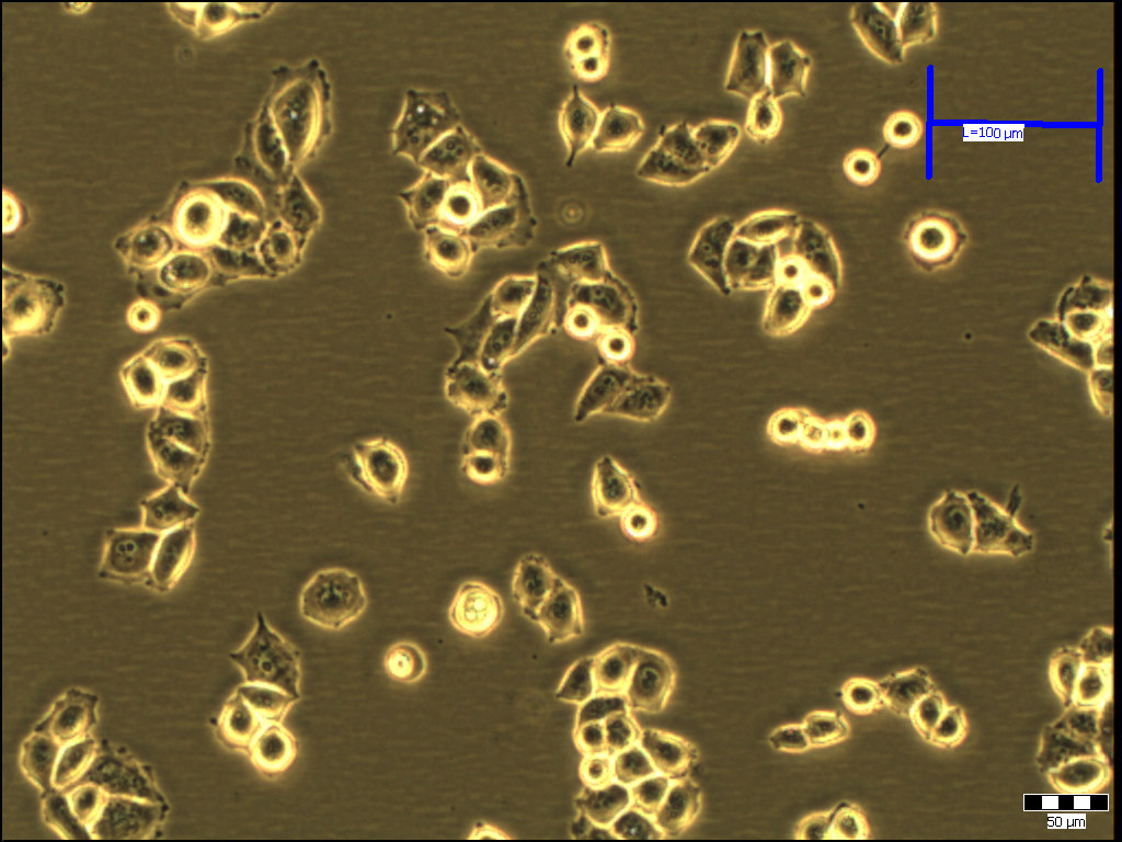 3 Materialer og metoder A B Figur 3.1: A) Fotomikrografi av ubehandlede NHIK 3025 celler. B) Fotomikrografi av ubehandlede NHIK 3025 (dox) celler, legg merke til cellenes endrede morfologi.
