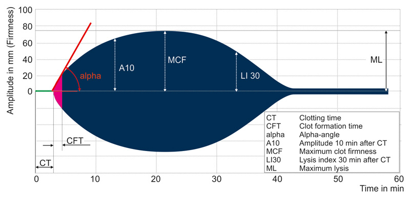 (RO)TEM (Thromboelastometry) [22] Viskoelastometrisk metode for hemostasetesting i fullblod.