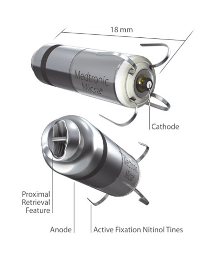Leveringskateteret for pacemakeren føres gjennom Micra -introduceren og kan flekteres distalt for å kunne passere trikuspidalostiet.