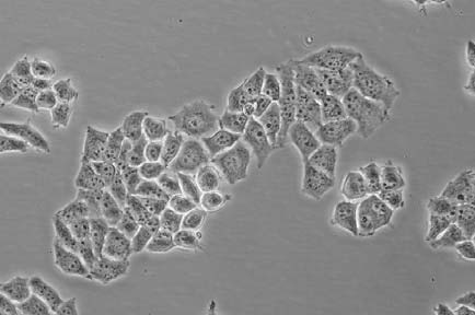 Resultat a) b) Figur.: Bilete av NHIK 05-celler. a) Ubestrålte celler. b) Celler som har vorte bestrålt i 7 veker, til ein totaldose på om lag Gy.