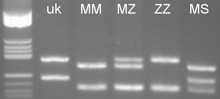 α1-antitrypsinmangel Genotyping av Z- og S-variantene av α1-antitrypsin 1 2 3 4 5 6 Z S RFLP