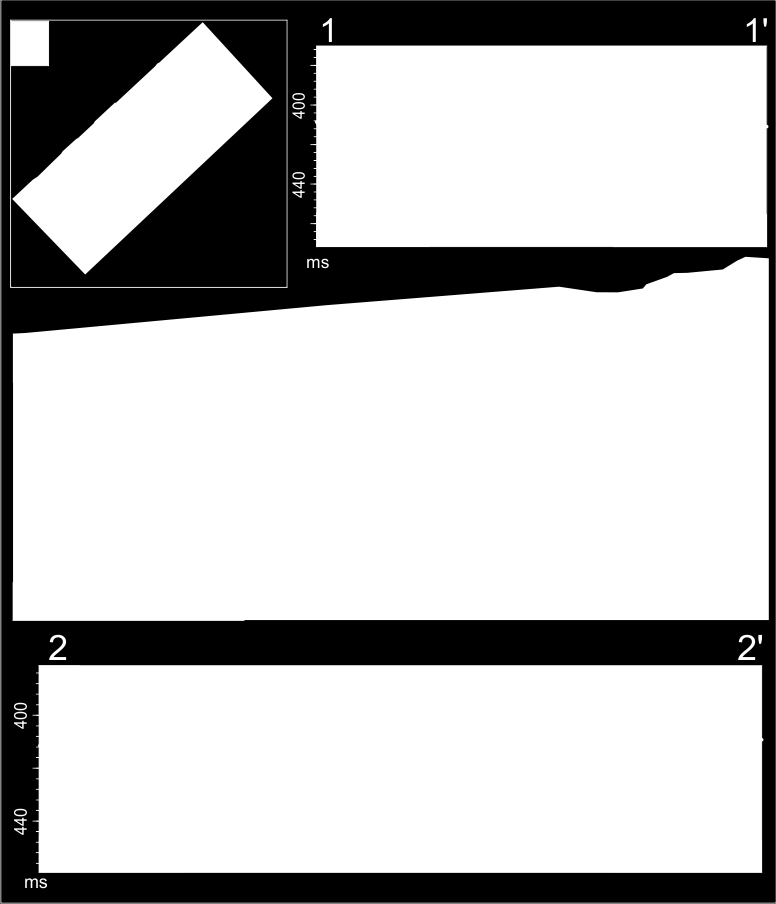 Lilla polygon viser lokaliseringen til C. 3.3.2 Tolkning av kurvede furer på begravd flate i ST0828, ST10011 og ST0309 De kurvede furene på den begravde flaten er tolket til å være isfjellpløyespor.