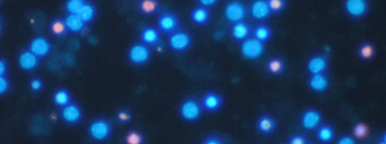 Etter endt eksponering ble cellene farget med både propidiumiodid og Hoechst 33342, for å merke både hhv. nekrotiske og apoptotiske celler (figur 3.32).