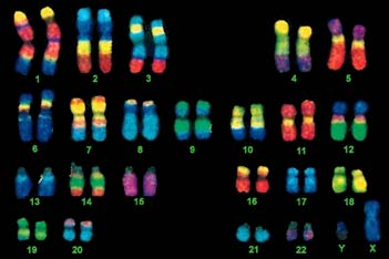 oppgaven Sykdom Informasjon om gen-produktet: Behandling/ profylakse 7 Fysisk kartlegging - metoder Kromosomfarging