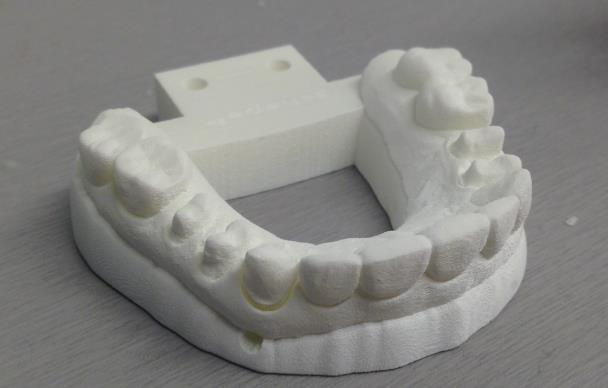 preparasjonsgrense, form etc. 4 Det er også mulig å sende meldinger frem og tilbake mellom tannlege og tekniker i programvaren.