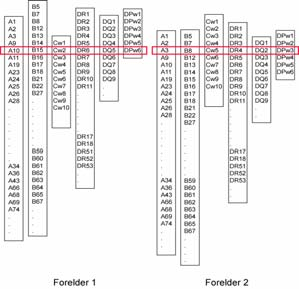 HLA molekylene er polymorfe Enkelte HLA molekyler (alleler) er assosiert med sykdom Sykdom HLA-molekyl Frekvens i