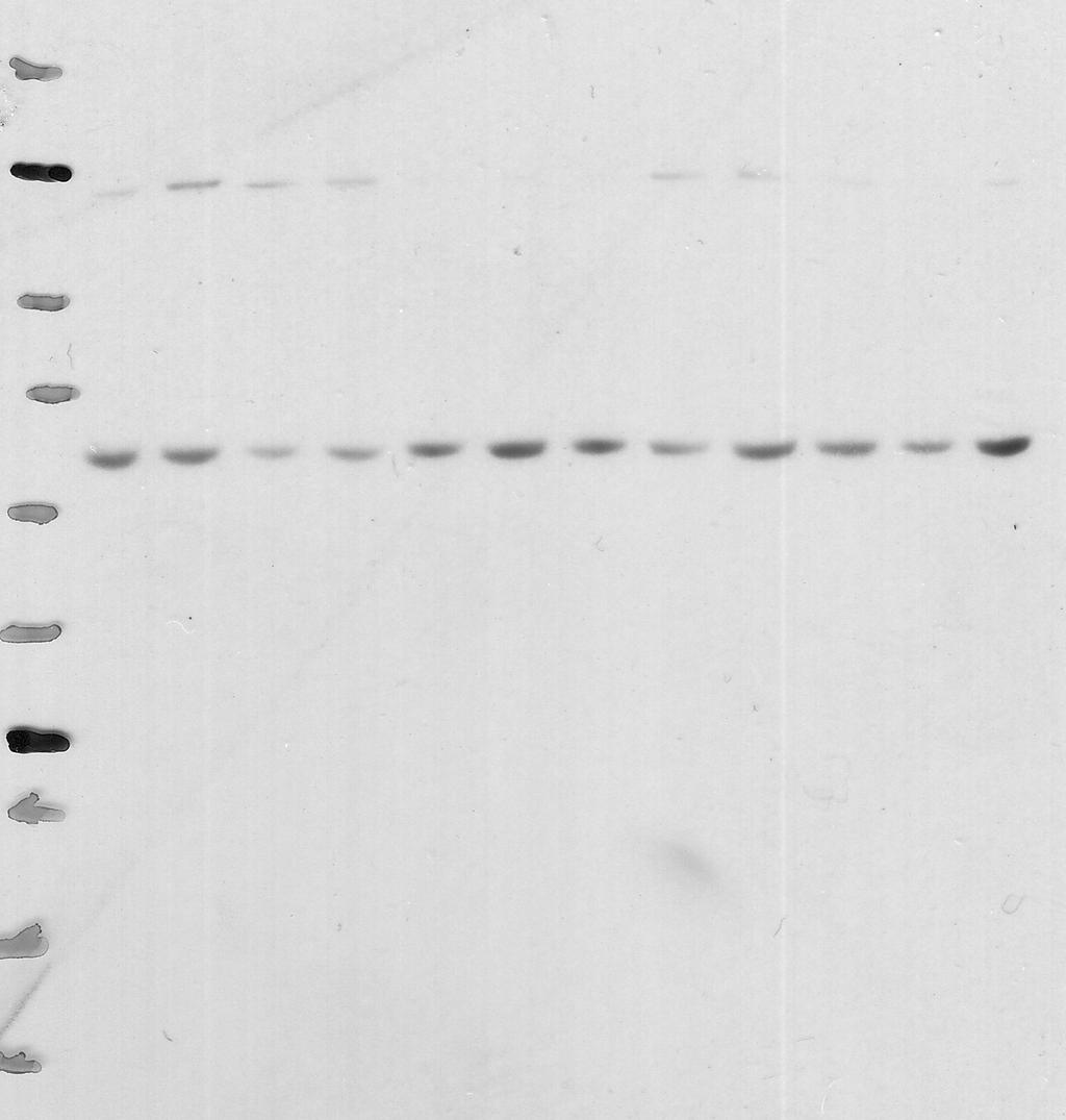 Western blots from NuPage 4-12% SDS-PAGE gels