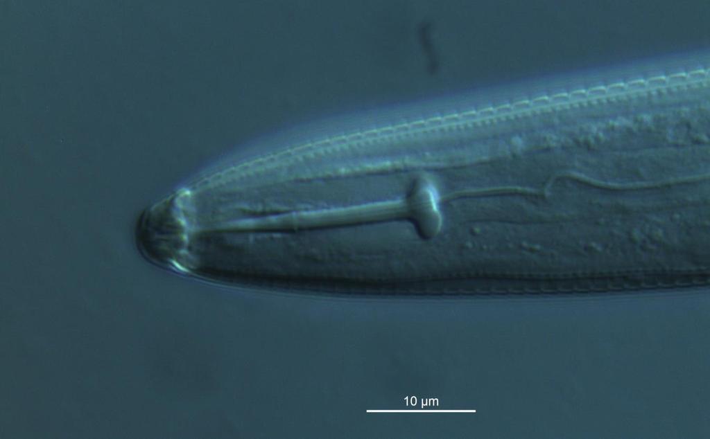 Utformingen av munn og svelg hos nematodene varierer med hva de spiser. Planteparasittære nematoder har en kraftig munnbrodd (stilett), som denne spiralnematoden Helicotylenchus pseudorobustus.