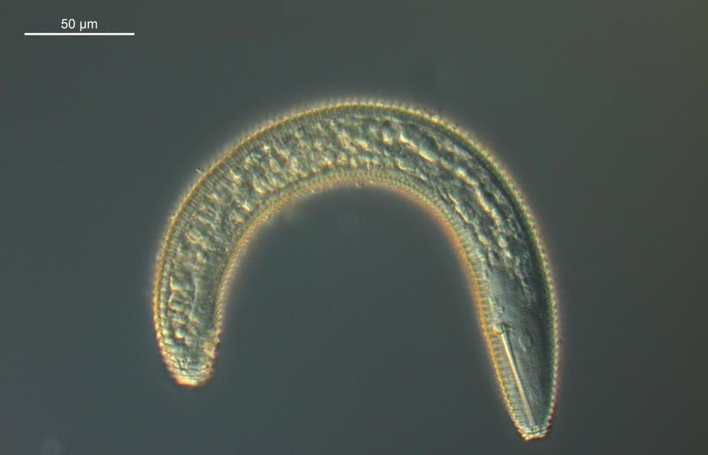 Pin-nematoden Paratylenchus projectus, fra en prøve tatt i en åker med knollselleri. Foto: Christer Magnusson Ringnematode (Macroposthonia spp. og flere arter i u.fam.