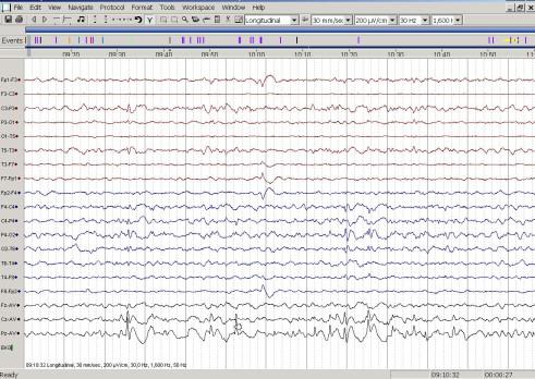 Spike wave