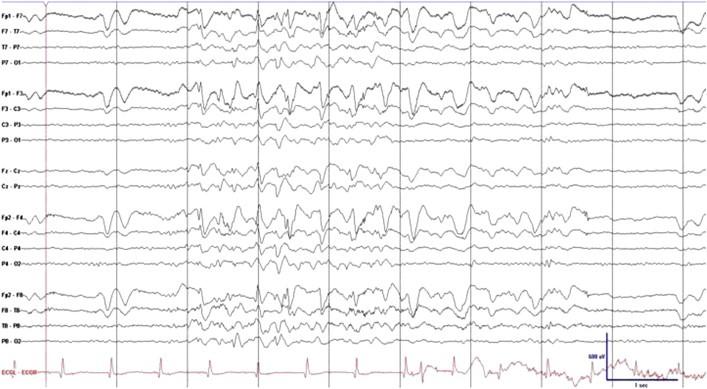 Vendrame, M et al.