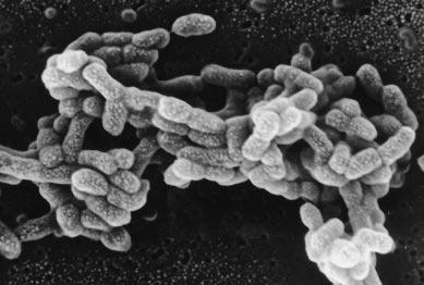 Forbehandling av substrater Utfordringer: mikroorganismer greier nesten ikke å nedbryte lignin, hemicellulose og andre stabile stoffer