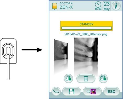 Bruks- og vedlikeholdsanvisningene til den innebygde ZEN- Xi sensoren er vedlagt apparatet. Det anbefales å lese anvisningene nøye før du slår på sensoren.