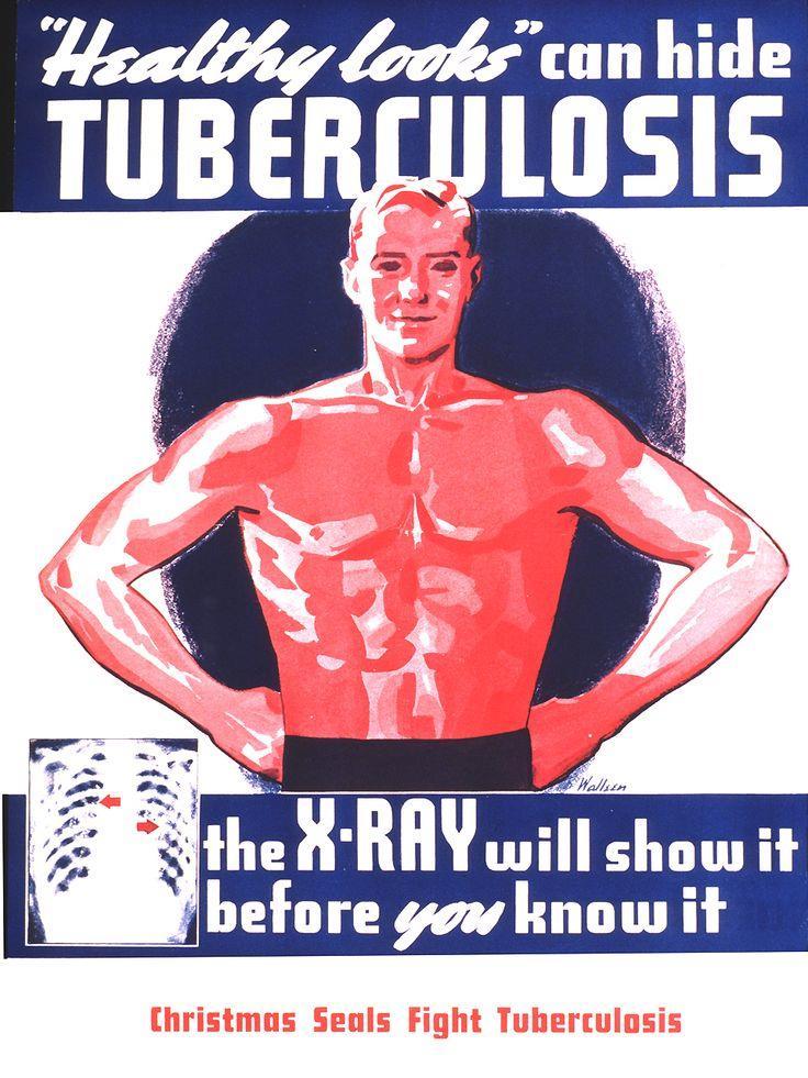 Tema Hvorfor screene for TB?