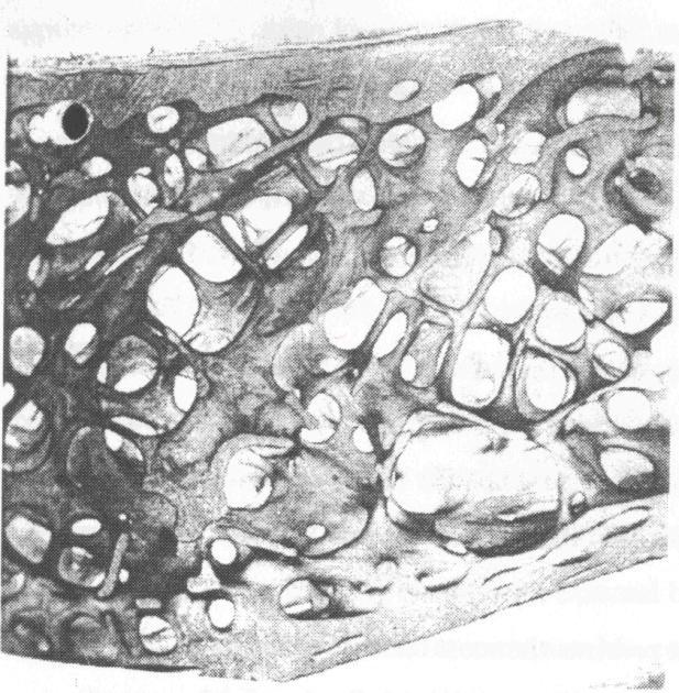 Beinvev består av tre celletyper: osteoblaster, osteocytter og osteoklaster.