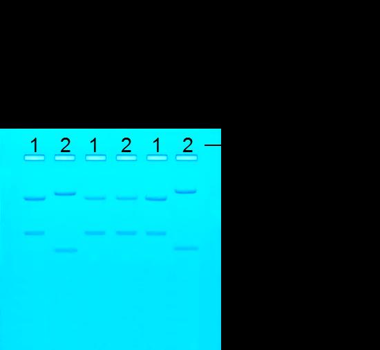 DNA-profilen til mistenkt B samsvarer med den til DNAet fra åstedet, mens mistenkt A har en DNA-profil som skiller