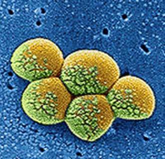 En (makro- og mikro-)verden i endring Sterkt økende forekomst i verden, men også økende i Norden og Norge Økende utvikling og seleksjon av resistente bakterier Kinoloner 3. og 4.