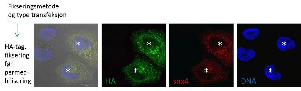 Figur 7: Det polyklonale SNX4-antistoffet gjenkjenner overuttrykt SNX4 HeLa-celler ble transfektert med Hemaglutinin(HA)-tagget SNX4-cDNA i 24 timer. Cellene ble fiksert med PFA i 15 minutter på is.