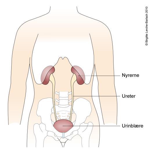 Medisinske følgetilstander hos voksne Urinveier utposninger i