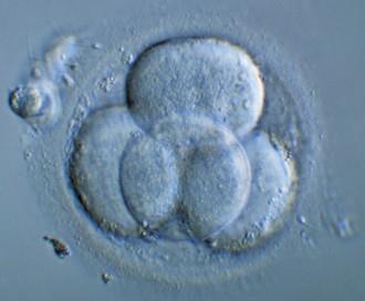 Autosomal dominant arv Delesjonen oppstår i eggcellen eller sædcellen før befruktningen Fosteret får delesjonen i alle sine celler Minimal
