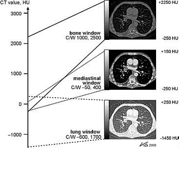 Kalender W, Computed Tomography, 2000 WL angir nivået, dvs