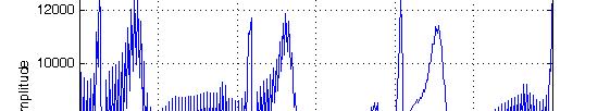 Støyfiltrering på EKG-signal Matlab: