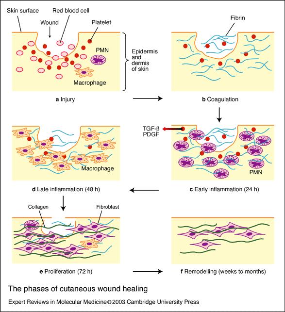 Innledning 3.3. Sårheling Sårheling er en kompleks prosess som involverer hemostase, inflammasjon, angiogenese og regenerering av huden.