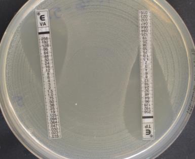 VANKOMYCIN VARIABLE ENTEROKOKKER vana PCR positive med glykopeptid følsom fenotype som