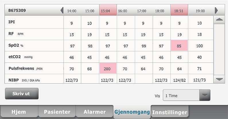 Merk Målinger som utløser en fysiologisk alarm blir markert på denne fanen. 2. Berør Vis-listeboksen for å endre trendintervallet. Standard trendintervall er 1 minutt. 3.