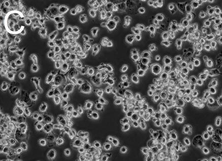 Celler stimulert med høy PMA (metode 2), sammenlignet med lav PMA (metode 1), var også mer adherente. Figur 4.2.: M1- og M2-makrofager utviste ulik karakteristikk under mikroskop.
