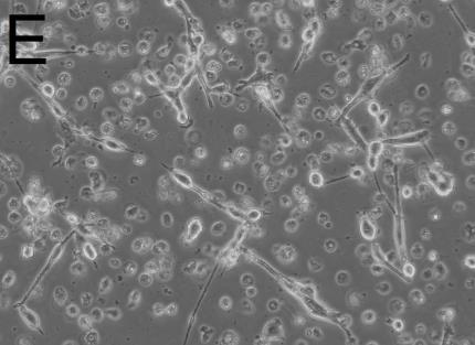 Bilder av celler er tatt rett før høsting med 10 X forstørrelse i lysmikroskop. 4.2.