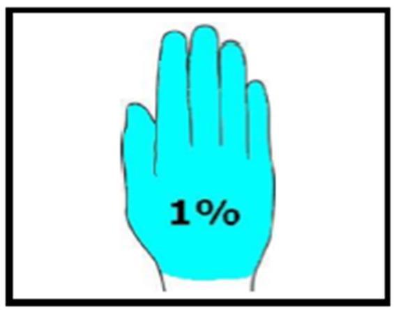 til på bena HÅNDEN ER 1% Pasienten sin håndflate og fingre svarer til ca.