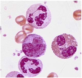 Side 5 av 39 Nøytrofil stavkjernet granulocytt [Nedtrekkliste] Segmentkjernet nøytrofil granulocytt [Nedtrekkliste] Basofil granulocytt [Nedtrekkliste] Makrofag [Nedtrekkliste] Erytrocytt