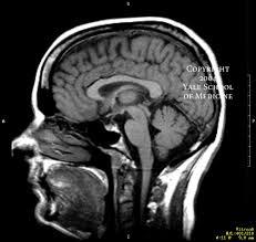 blant annet magne6c resonance imaging og i mange spektroskopiformer Men kan