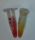 Inkuber: 30min. r.t. MH, blod agar (Screening agar) Drigaski /MacConkey agar kan ikke brukes!