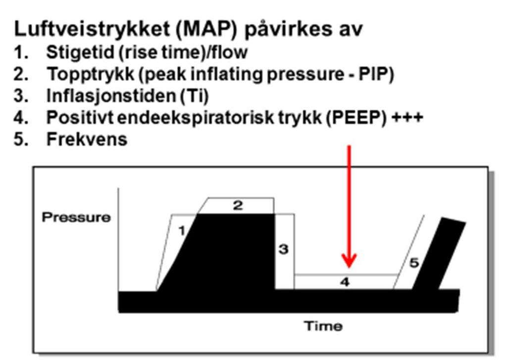 Hva bestemmer oksygenering? Generelt bestemmes oksygeneringen av MAP (mean airways pressure). MAP påvirkes av PEEP, inflasjonstid (Ti), PIP (topptrykk), stigetid og frekvens.