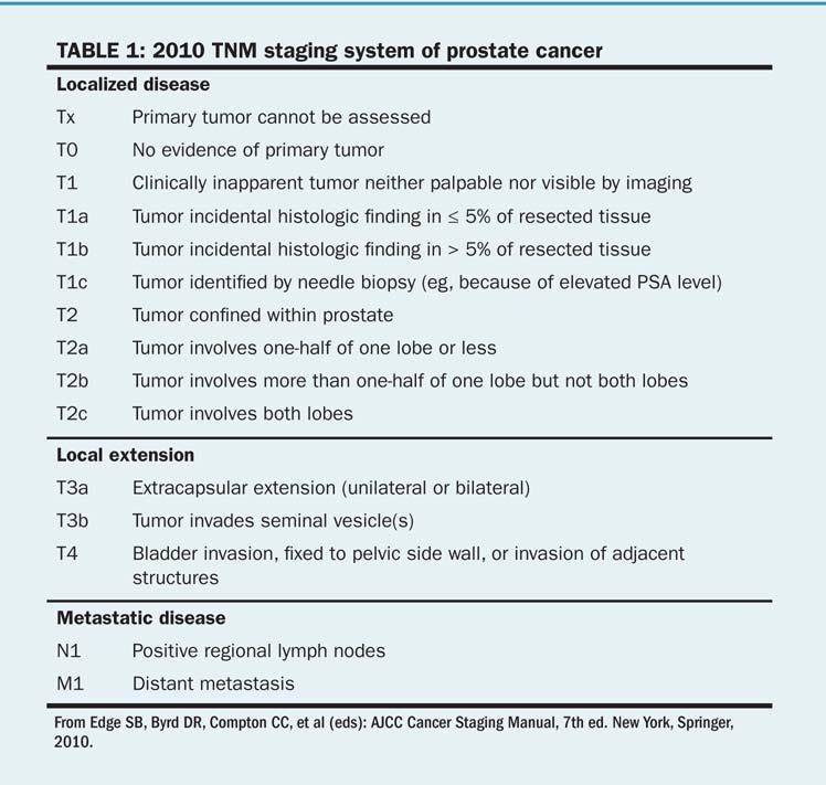 .8 TNM-klassifisering Den mest utbredte kliniske klassifiseringen av PCa benytter TNMsystemet [4]. Tabell 3: TNM staging. Kilde: UBM Medica. Det forelå 5 beskrivelser av klinisk stadium i journalene.