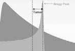 Protonterapi Fremtidige perspektiver Intensitet-modulert protonterapi Illustrasjon fra RINECKER PROTON THERAPY